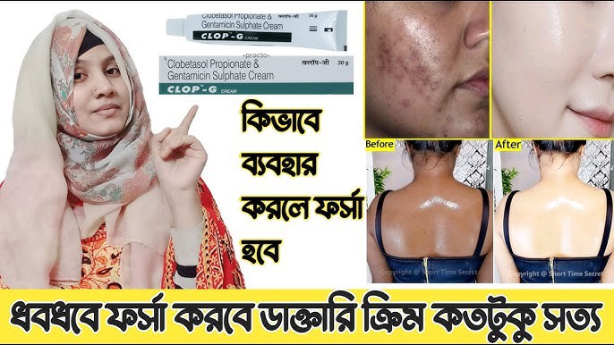 Clop G Clobetasol Propionate Cream 30gm