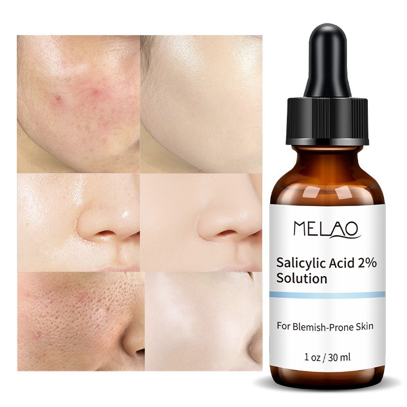 Melao- Salicylic Acid Serum 2% Concentrate For Face -30ml