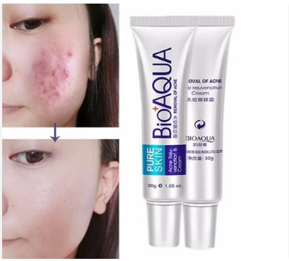BIOAQUA Pure Skin Acne Removal and Rejuvenation