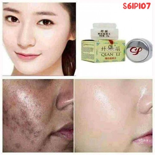 Ql Qian Li Whitening Cream 20 gm