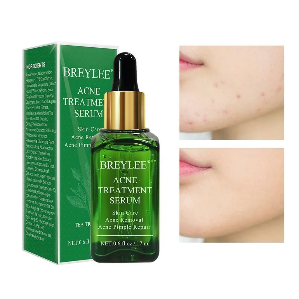 Breylee Acne Treatment Serum 17ml