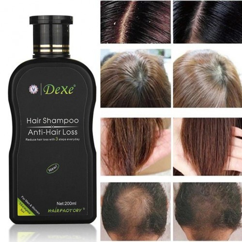 Dexe Anti Hair Loss Shampoo 200ml (Men & Women)
