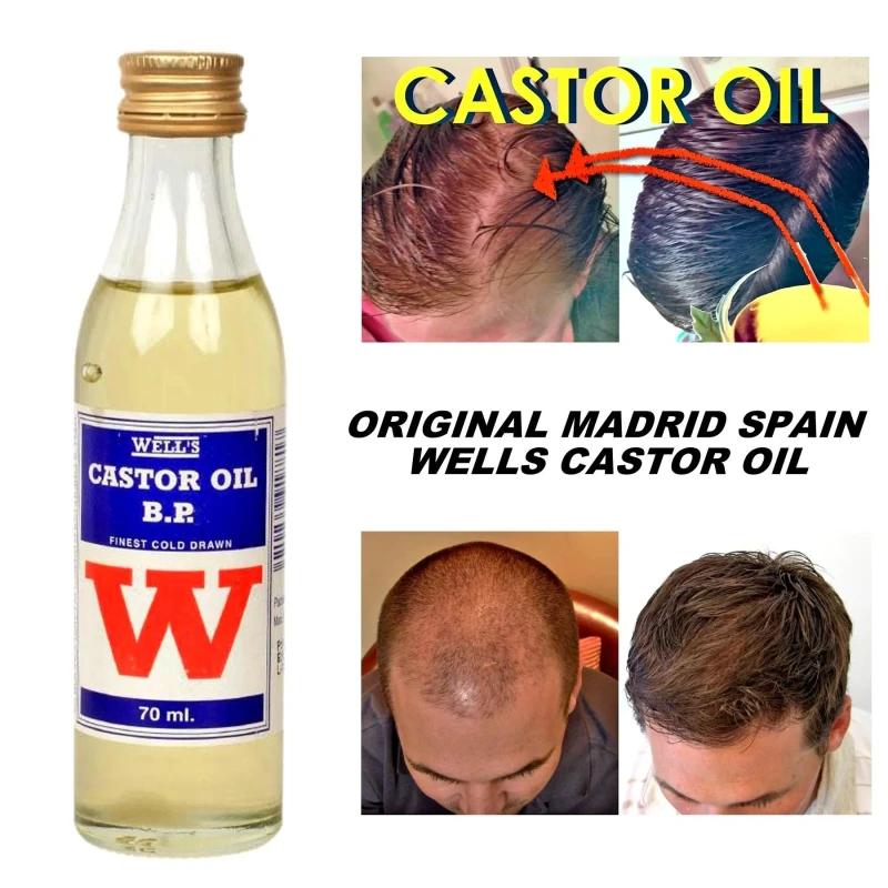 Castor Oil B. P. 70ml 100% Original