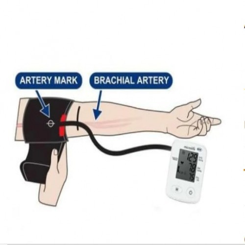 Microlife A2 Classic Digital Blood Pressure Monitor with PAD technology