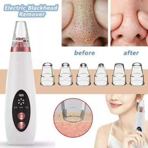 Cleaning Remove blackhead device Best Price In Bangladesh
