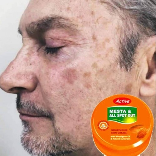 Active Mesta and All Spot Out Nourishing Skin Cream indian
